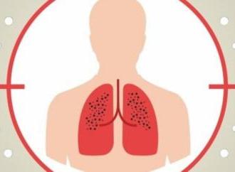 Фтизіатрія