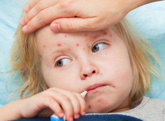 Інфекційні хвороби