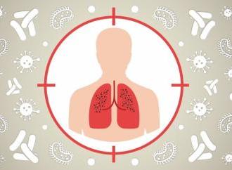 Фтизіатрія