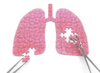 Фтизіатрія