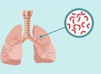 Фтизіатрія