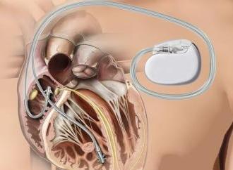 Кардіологія