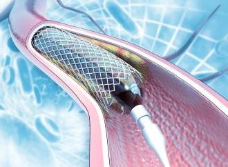 Кардіологія